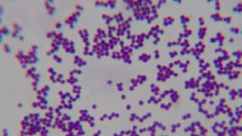 gambar : Staphylococcus epidermidis
